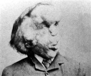 Elephant Man : l'histoire de Joseph Merrick Thtre du Carr Rond Affiche